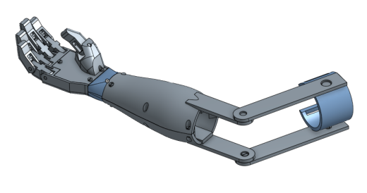 arm prosthesis机械手臂假肢结构缩略图