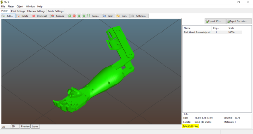 arm prosthesis机械手臂假肢结构缩略图