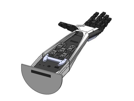 Prosthetic arm prototype假肢仿生手缩略图