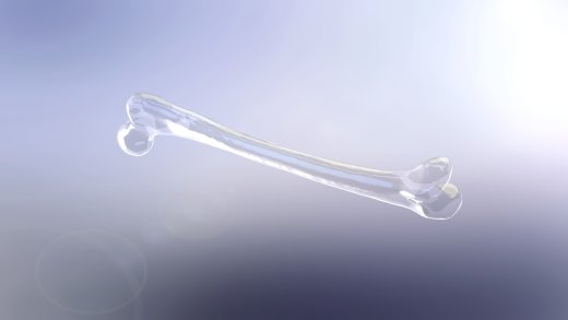 3D 扫描文件的股骨模型缩略图
