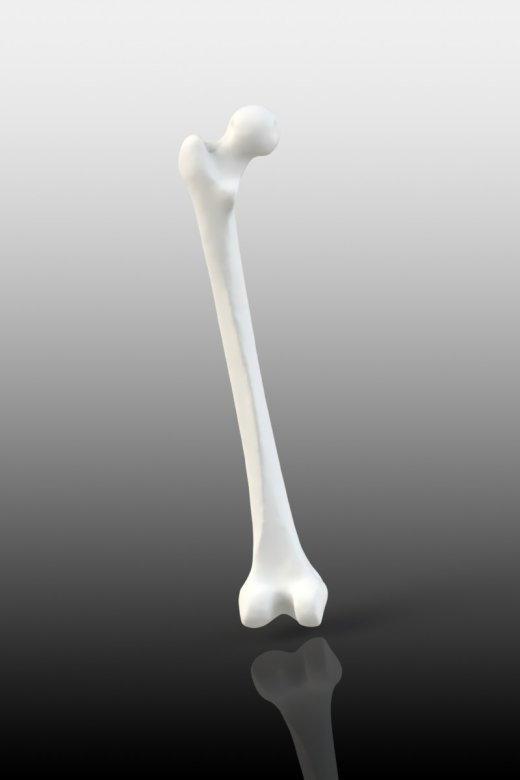 3D 扫描文件的股骨模型缩略图