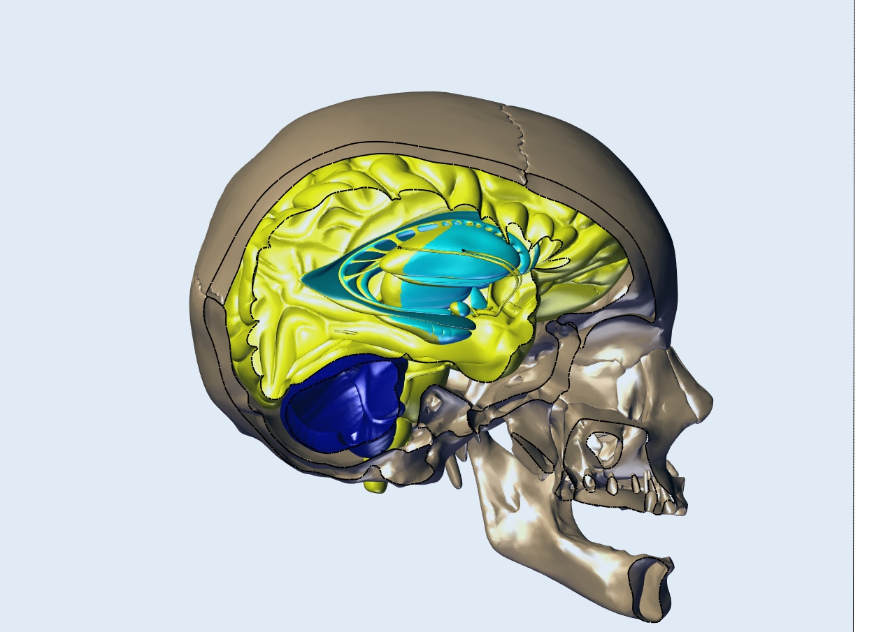 人类大脑和头骨