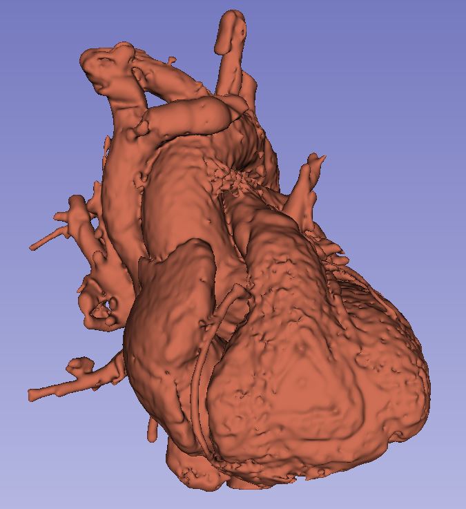 人心脏的3D模型