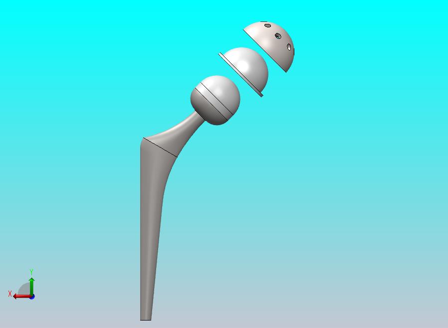 髋关节假体